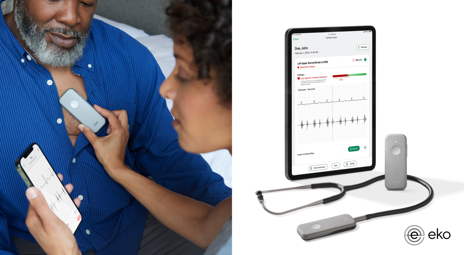 15-Second Heart Failure Test: Eko's AI Stethoscope Gets FDA Nod